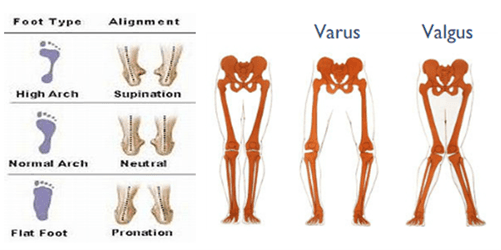Scientific diagram outlining the impacts of differing foot types, foot alignments and leg alignments